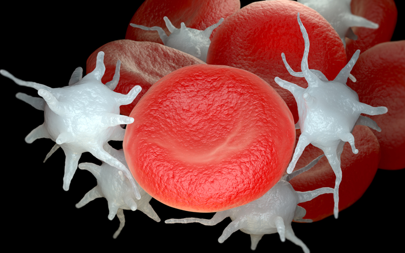 Essential Thrombocythemia